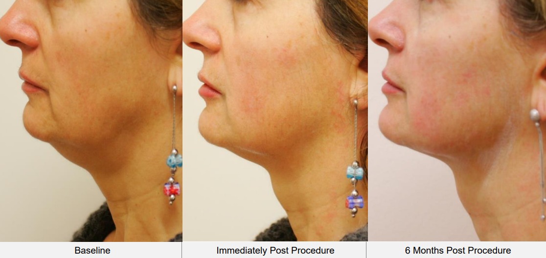 PHOTO-2023-10-27-11-45-42