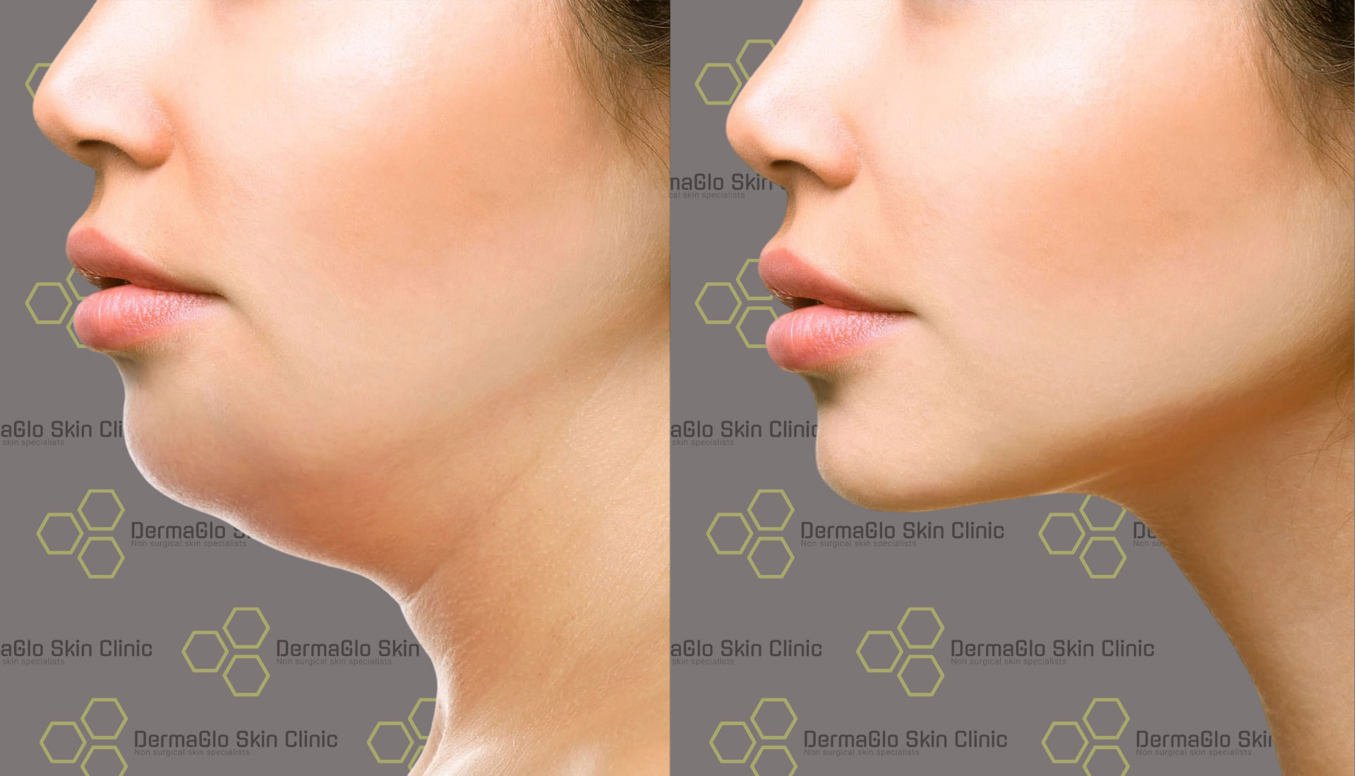 Untitled-design-(76)