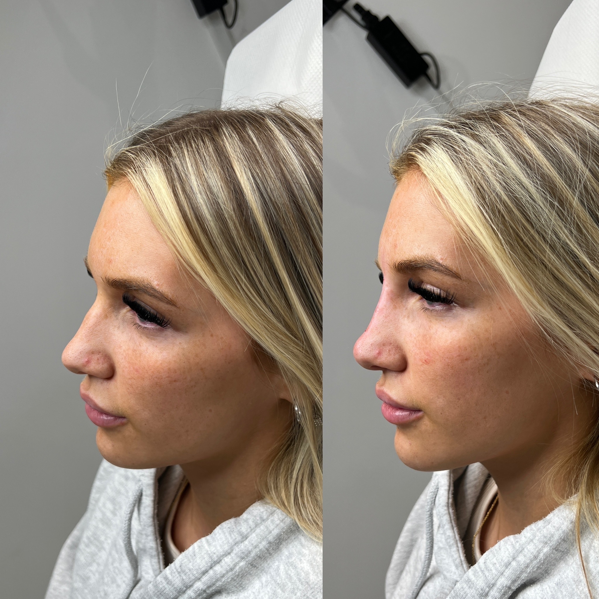 AB243932-89CD-4AD9-B4B1-55387D0EF50D