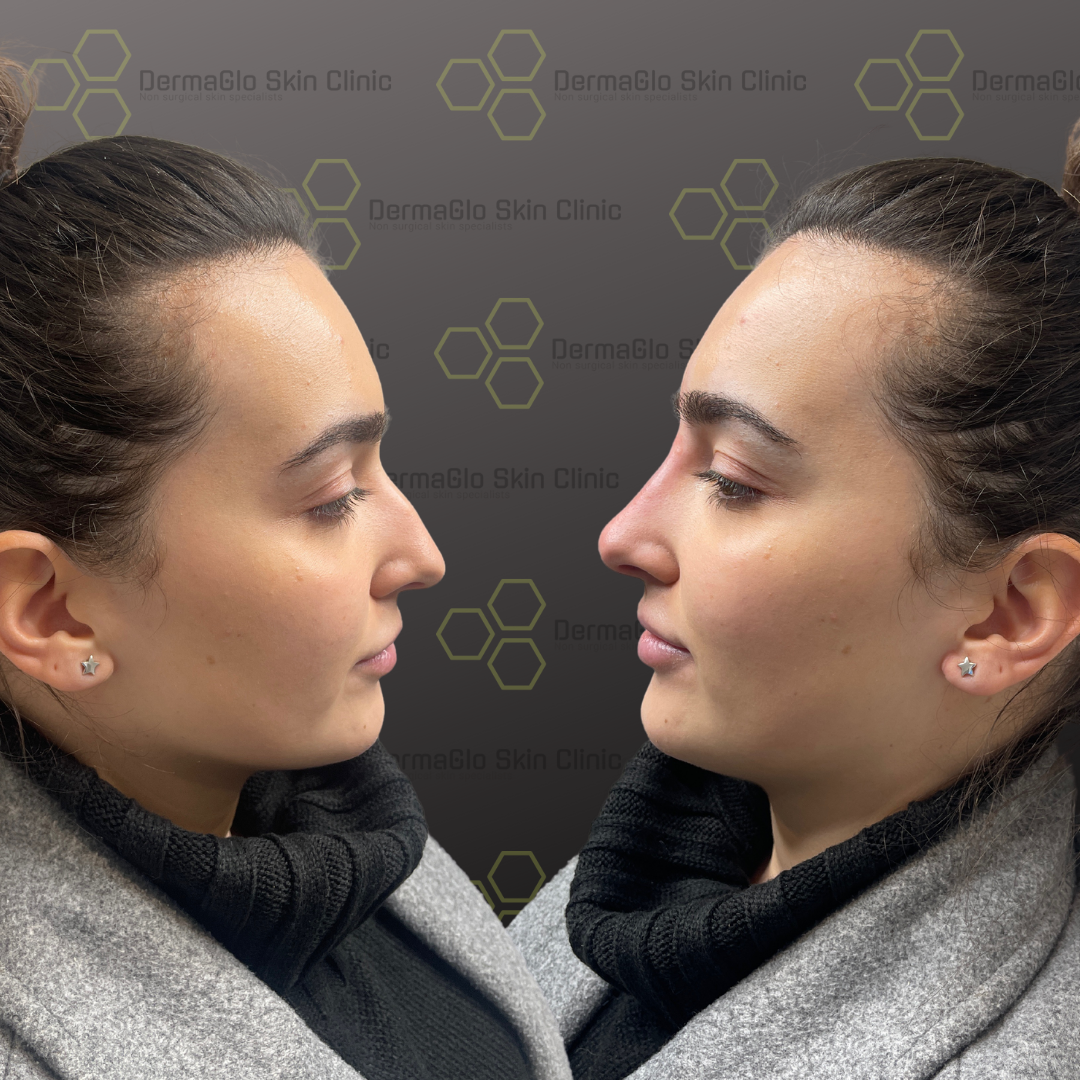 Copy-of-Copy-of-Copy-of-Copy-of-Copy-of-Untitled-Design-copy