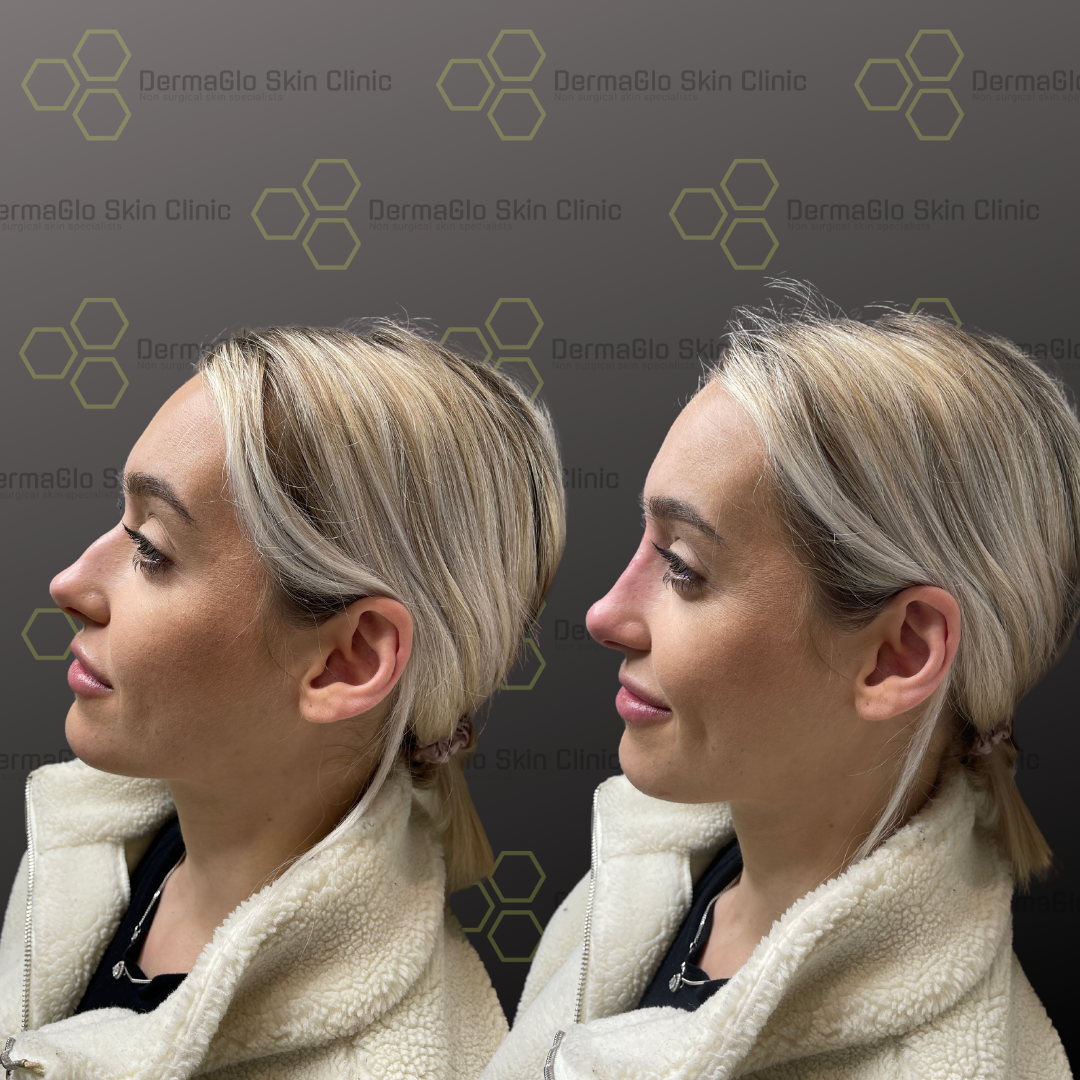 Copy-of-Copy-of-Copy-of-Copy-of-Copy-of-Untitled-Design