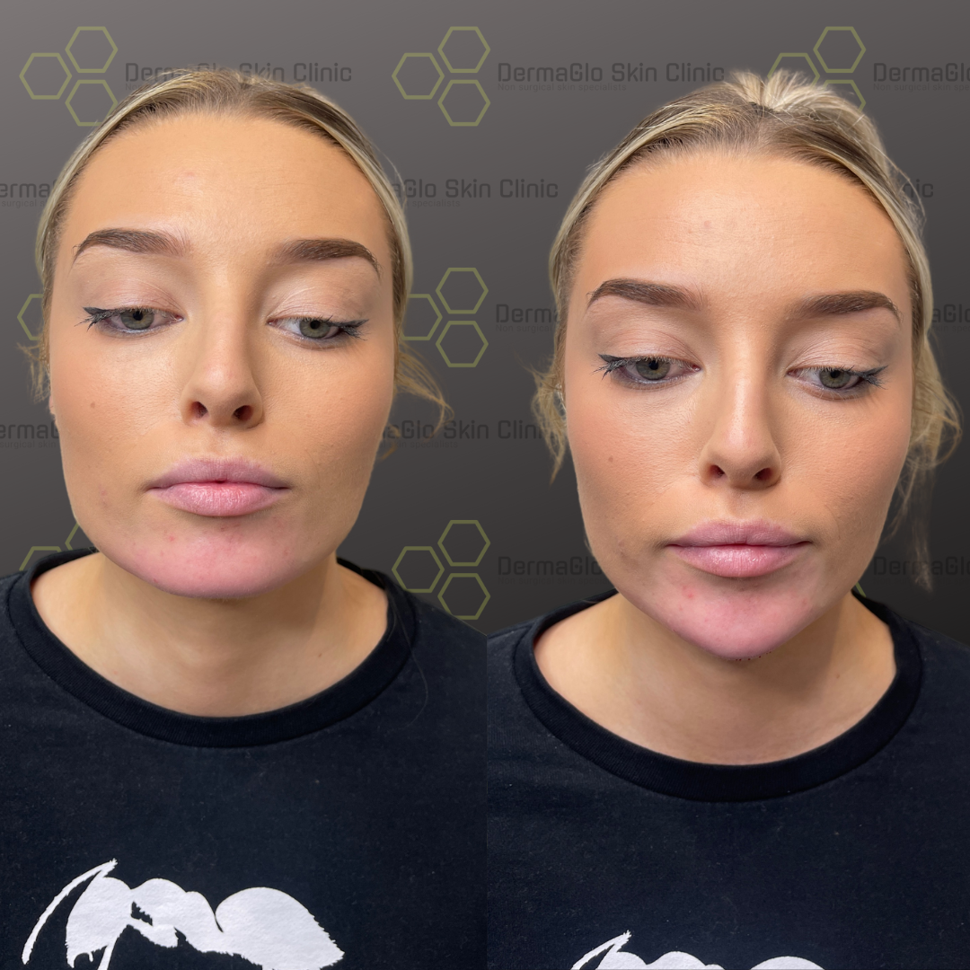 Copy of Copy of Copy of Copy of Untitled Design