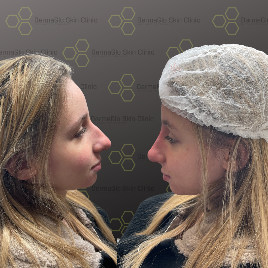 Copy-of-Copy-of-Copy-of-Untitled-Design