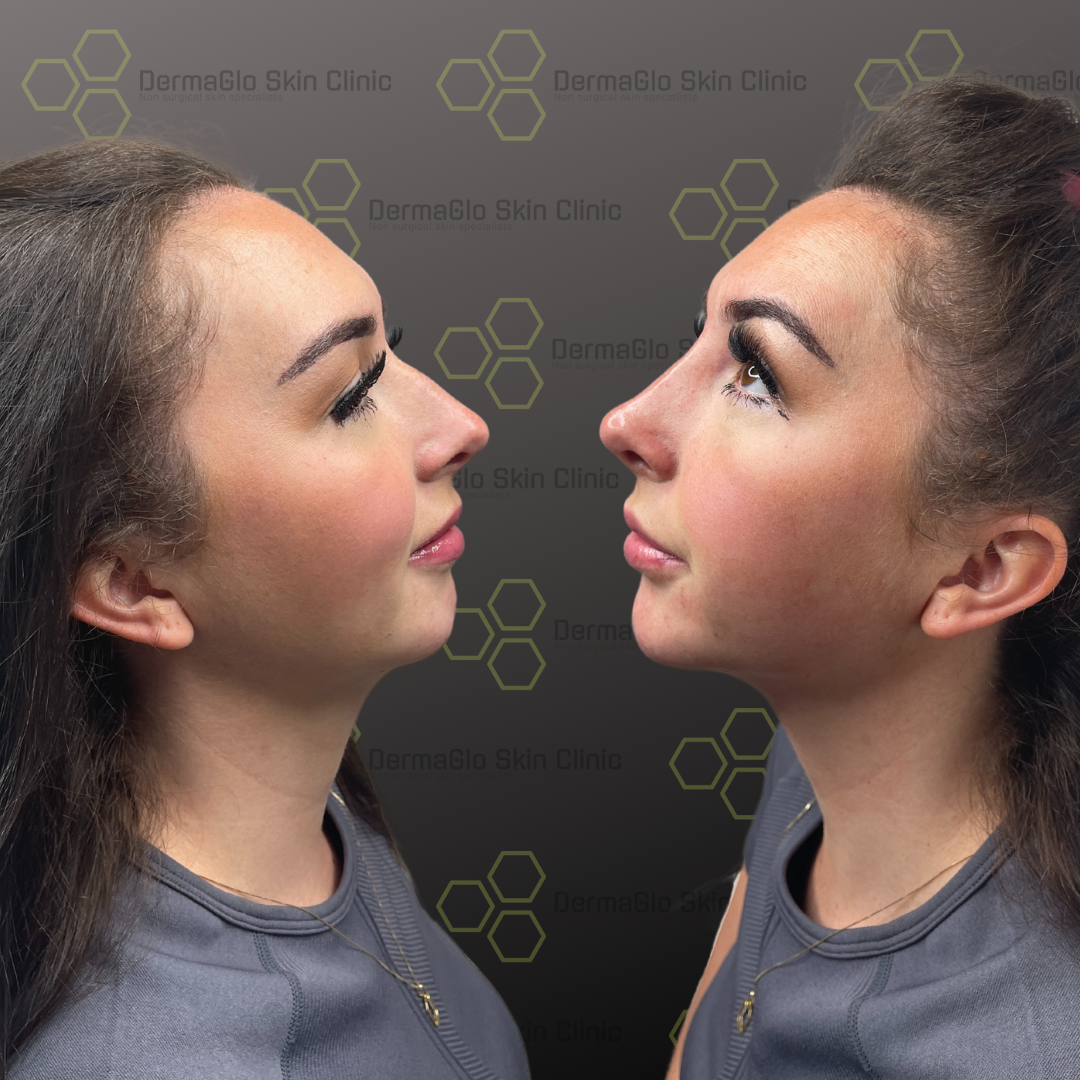 Copy-of-Copy-of-Untitled-Design-9 (1)