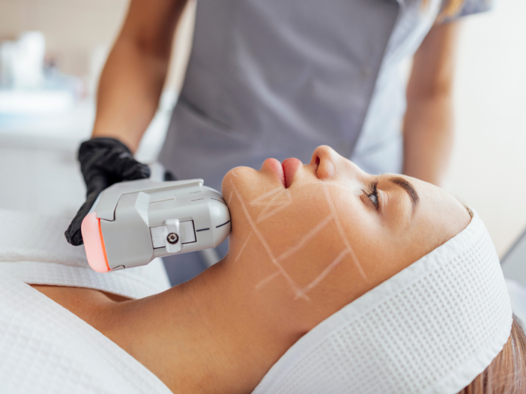 Woman receiving HIFU face lifting and skin tightening treatment at DermaGlo Skin Clinic.