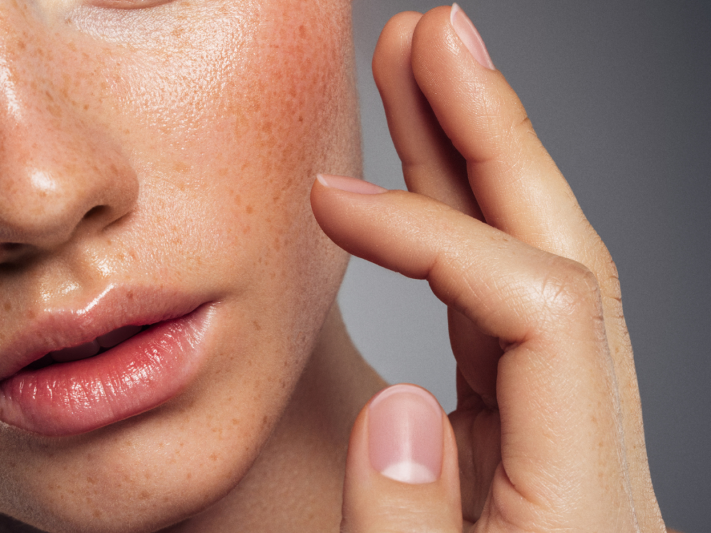 Close-up of healthy, radiant skin – SKIN CLUB treatments at DermaGlo Skin Clinic targeting pigmentation, acne, and rosacea.